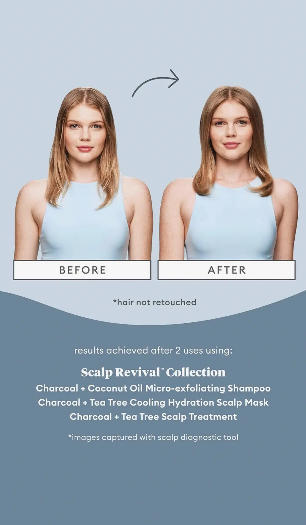 Briogeo Scalp Soothing Solutions Set Featuring Scalp Revival