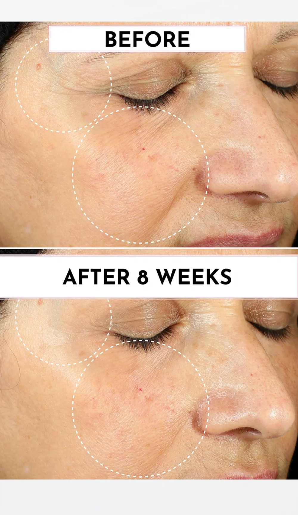 LAWLESS Forget the Filler Perfecting Cream