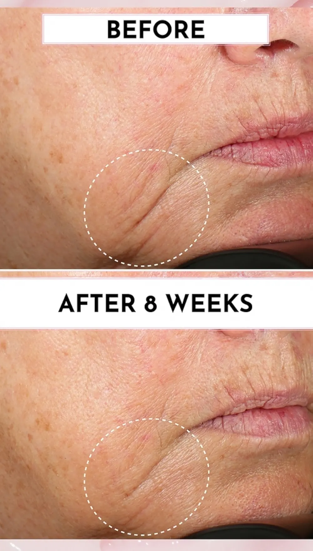 LAWLESS Forget the Filler Perfecting Cream