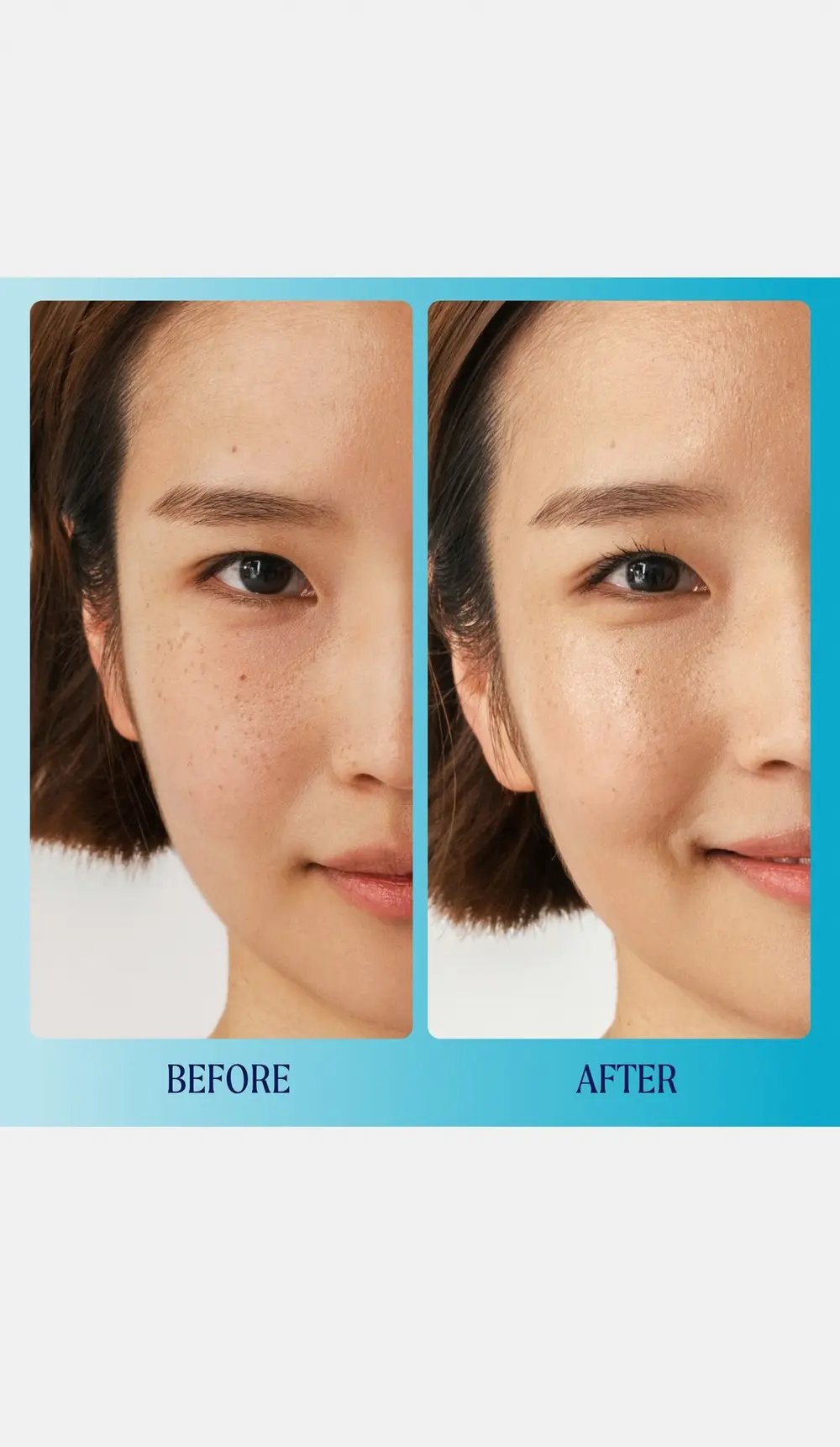 Kinship Supermello Hyaluronic Gel Cream Moisturizer