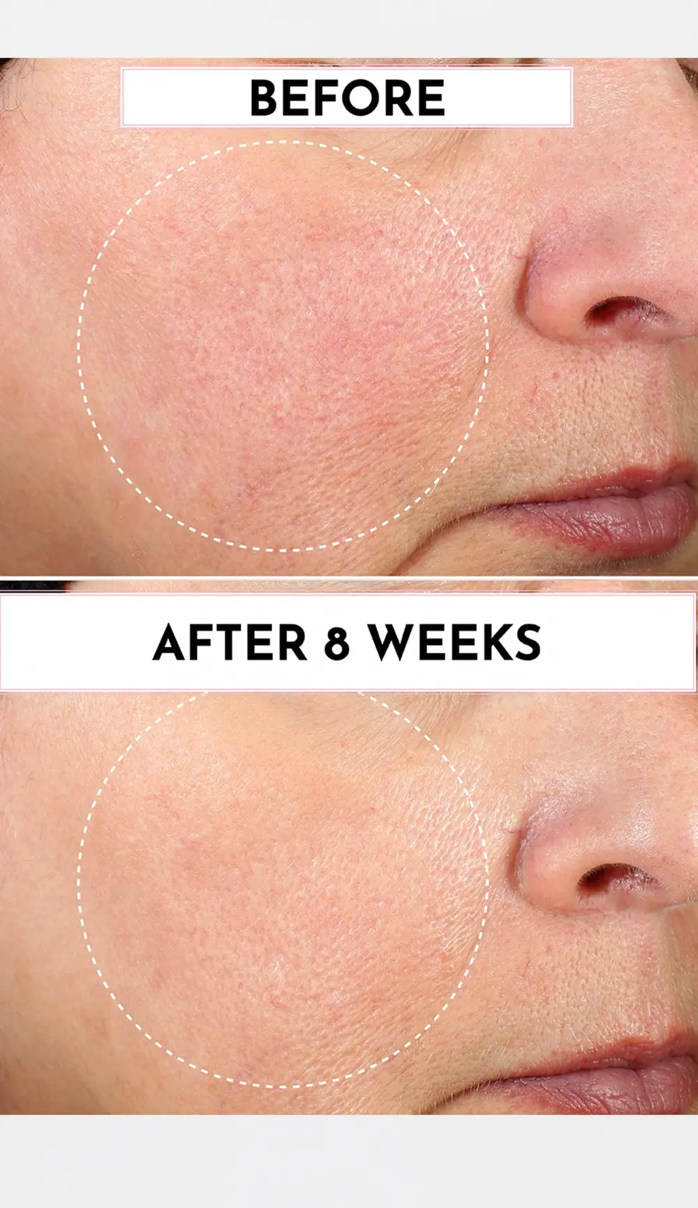 LAWLESS Forget the Filler Perfecting Cream